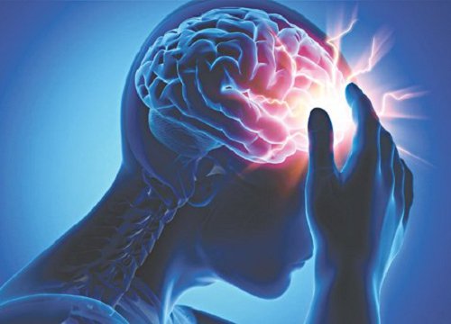Đột quỵ não: Chớ nên xem thường
