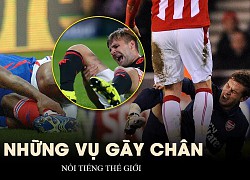 Những vụ gãy chân nổi tiếng nhất thế giới