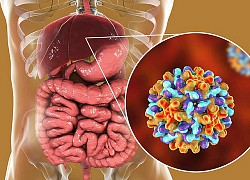 Đây là 4 lý do khiến bạn dễ bị ung thư gan: Cách phòng ngừa hiệu quả thật sự không khó