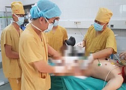 Tin vào quảng cáo "nhà 3 đời đắp thuốc nam" trên mạng, 2 người đàn ông bị hoại tử da, chảy mủ thối