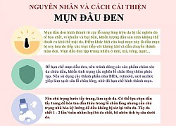 Cách chăm sóc da khi bị mụn đầu đen