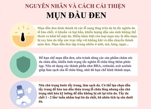 Cách chăm sóc da khi bị mụn đầu đen