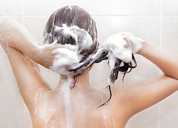 Dáng đẹp nhưng lưng mụn thâm chi chít, chị em chữa liền bây giờ vẫn kịp diện bikini