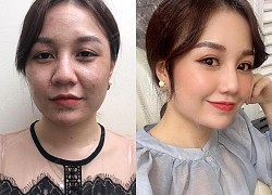 Hé lộ phương pháp trẻ hóa vượt trội trong năm 2021