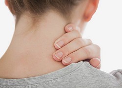 Cô gái 23 tuổi liệt nửa người vì thói quen bẻ cổ kêu răng rắc