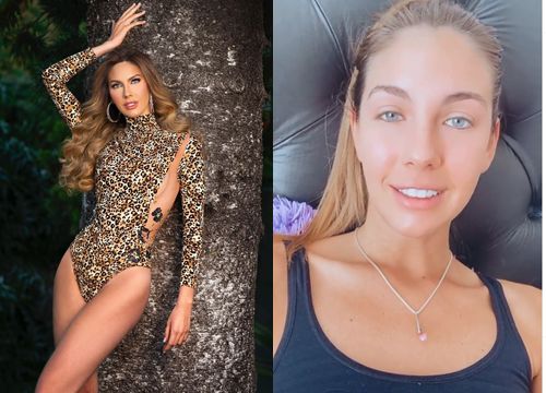 Tình hình sức khỏe của Hoa hậu Argentina bị nhiễm Covid-19 trước thềm Miss Universe