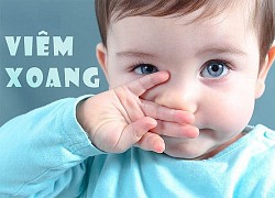 Trẻ em có bị viêm xoang?