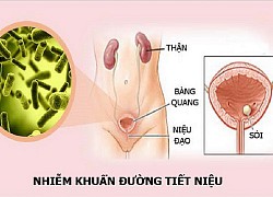 Nhận biết, phòng ngừa nhiễm trùng tiết niệu