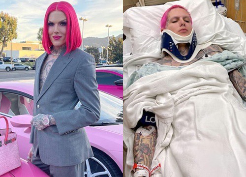 'Ông hoàng trang điểm' Jeffree Star gặp tai nạn nghiêm trọng