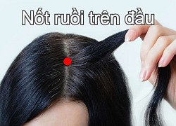 3 vị trí nốt ruồi tài lộc, đựng dại phá đi, xui xẻo có thể ập đến bất cứ lúc nào