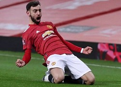 Bruno Fernandes: &#8220;Luke Shaw là hậu vệ trái xuất sắc nhất NHA hiện tại&#8221;