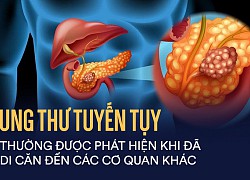 Các yếu tố làm tăng nguy cơ ung thư tụy