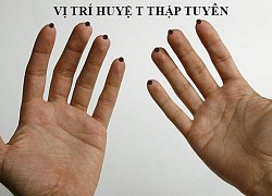 Huyệt thập tuyên trị say nắng