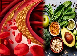 Những quan niệm sai lầm về cholesterol