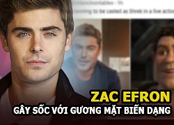 Zac Efron &#8211; Mỹ nam High School Musical gây sốc với gương mặt biến dạng vì dao kéo