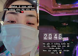 Hoà Minzy bất ngờ đăng ảnh cận đôi mắt sưng vù và đỏ hoe đáng lo lắng, chuyện gì đây?