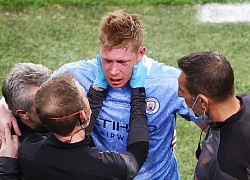 De Bruyne nguy cơ lỡ Euro 2020 vì gãy xương mũi