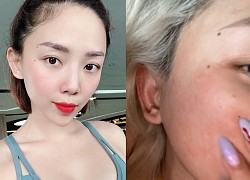 Vì sao Tóc Tiên bị mẩn đỏ khi dùng retinol?