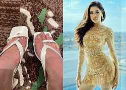 Ai nấy đều xót xa khi thấy hình ảnh chân Khánh Vân bị phỏng rộp