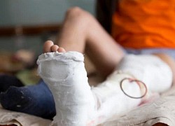 Cậu bé tự tháo tấm ngăn cửa sổ, rơi từ tầng 5 chung cư xuống đất