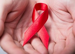 Người nhiễm HIV tăng nguy cơ mắc và tử vong do COVID-19