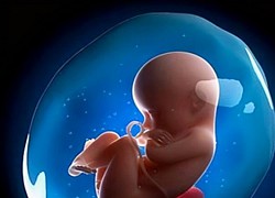 Vừa nhìn con chào đời, ông bố sợ tái mặt không dám bế nhưng bác sĩ liền chúc mừng điều may mắn hiếm có