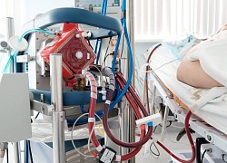 Bệnh nhân Covid-19 trẻ tuổi phải đặt ECMO