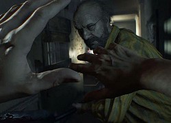 Cộng đồng game thủ ám ảnh trước cách Ethan gắn lại bàn tay trong Resident Evil Village