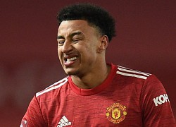 Lingard bị loại, Arnold cùng tuyển Anh dự Euro 2020