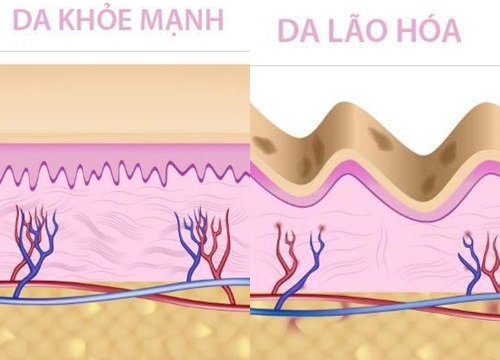 Biện pháp dễ thực hiện giúp làm chậm lão hóa da