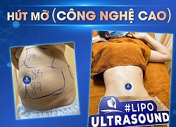 Vì sao hút mỡ công nghệ cao (Lipo Ultrasound) được nhiều khách hàng lựa chọn