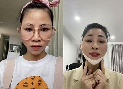 Bị "tố" gọt cằm, nâng mũi, Thơ Nguyễn phản pháo netizen: Nếu phẫu thuật thì sẽ nhận!