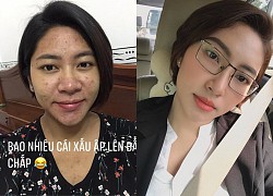 Hoa hậu Đặng Thu Thảo tự khoe ảnh nhan sắc tàn phá và mụn mọc chi chít sởn da gà vì bầu bí, thái độ tích cực thật đáng khâm phục!