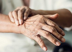 Cách nhận biết sớm dấu hiệu Parkinson