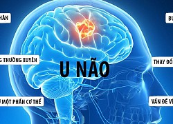 9 dấu hiệu cảnh báo u não ở trẻ em, cha mẹ chớ bỏ qua