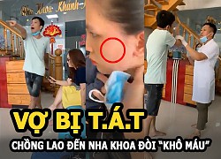 Vợ bị tát xưng mặt vô lý, chồng hùng hổ lao đến nha khoa đòi &#8220;khô máu&#8221;