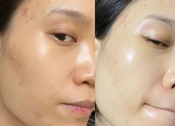 Dùng thử chai serum được Rosé quảng cáo, mình đã "ngả mũ" vì khả năng làm đều màu da hiệu quả