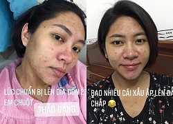 Đặng Thu Thảo nói về da mụn, vết rạn nặng vì sinh 2 con: "Buồn dữ lắm"