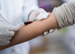 Nam thanh niên 22 tuổi nhiễm HIV/AIDS do "quan hệ" không an toàn: "Em không xác định được ai là nguồn lây"!?