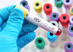 Kết quả xét nghiệm phát hiện nhiễm mới HIV - Bằng chứng khoa học cho chương trình phòng, chống HIV/AIDS