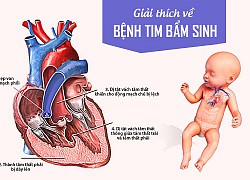 Trẻ mắc dị tật tim bẩm sinh cần lưu ý để tránh nhiễm khuẩn