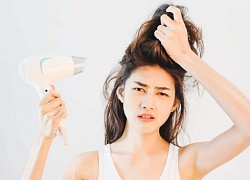 Những tín hiệu sức khỏe quan trọng từ gàu, ngứa, vi khuẩn trên da đầu