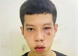 Bắt "nóng" đối tượng cướp tài sản của cụ bà vừa lĩnh lương hưu