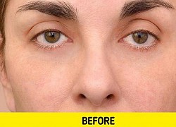 Hậu quả rửa mặt khi tắm, dưỡng da cầu kì đến mấy cũng vô ích