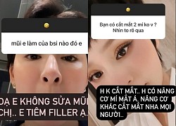 Hiền Hồ phủ nhận ồn ào phẫu thuật mũi, nhờ cậy filler, nâng cơ mí mắt