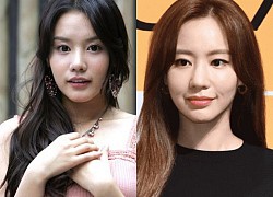 Kim Ah Joong "Sắc đẹp ngàn cân" tuột dốc nhan sắc vì lạm dụng dao kéo khiến netizen tiếc nuối