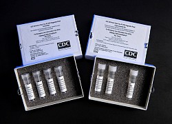 Mỹ ngừng sử dụng xét nghiệm PCR Covid-19 cuối năm nay