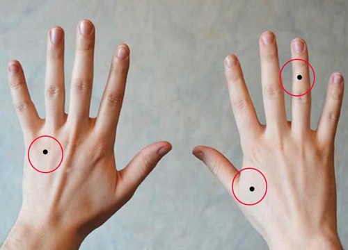 Nốt ruồi trên mu bàn tay nam và nữ có ý nghĩa gì đặc biệt