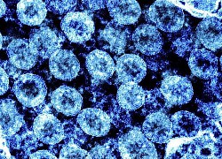 Người nhiễm biến thể Delta có thể lây lan virus 2 ngày trước khi có triệu chứng