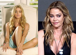 Denise Richards gây thất vọng với gương mặt biến dạng vì thẩm mỹ